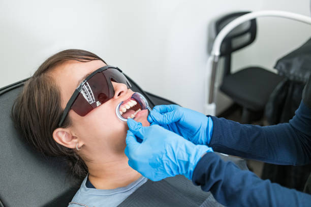 Best Teeth Whitening  in Rossville, IN